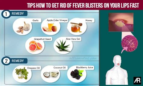 how to get rid of a fever.